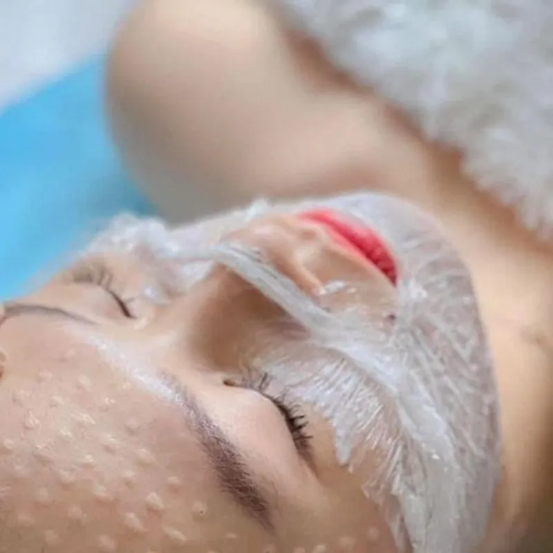 Những lưu ý quan trọng để tránh biến chứng khi tiêm Meso
